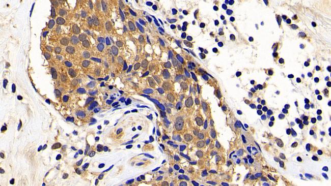 XIAP Antibody in Immunohistochemistry (Paraffin) (IHC (P))