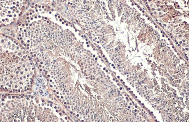 Androgen Receptor (ARv7 Splice Variant) Antibody in Immunohistochemistry (Paraffin) (IHC (P))