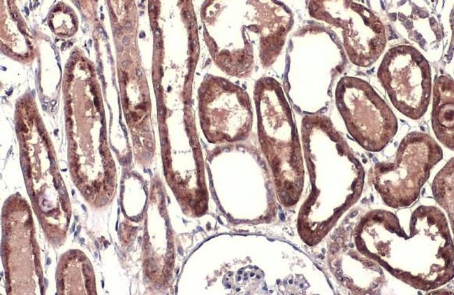 Cathepsin B Antibody in Immunohistochemistry (Paraffin) (IHC (P))