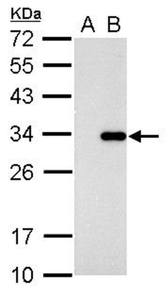 CDK2 Antibody in Western Blot (WB)