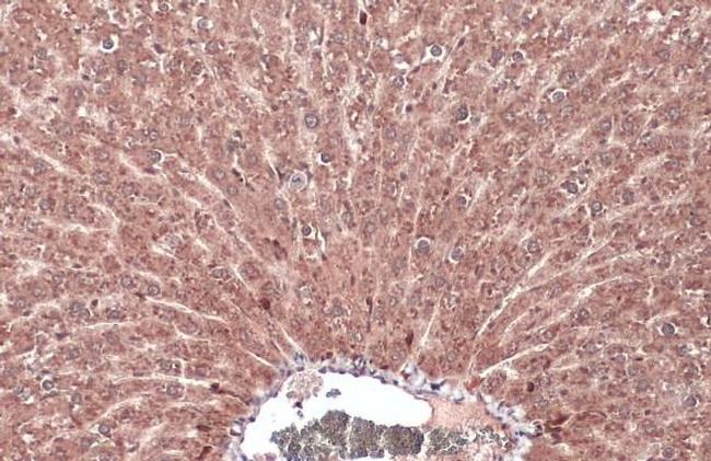 FGFR4 Antibody in Immunohistochemistry (Paraffin) (IHC (P))