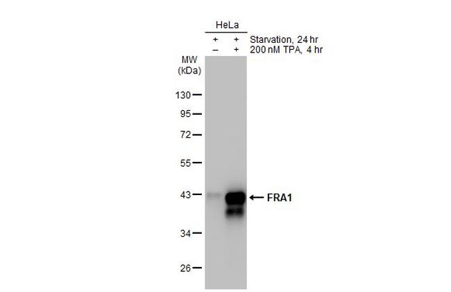 Fra1 Antibody in Western Blot (WB)