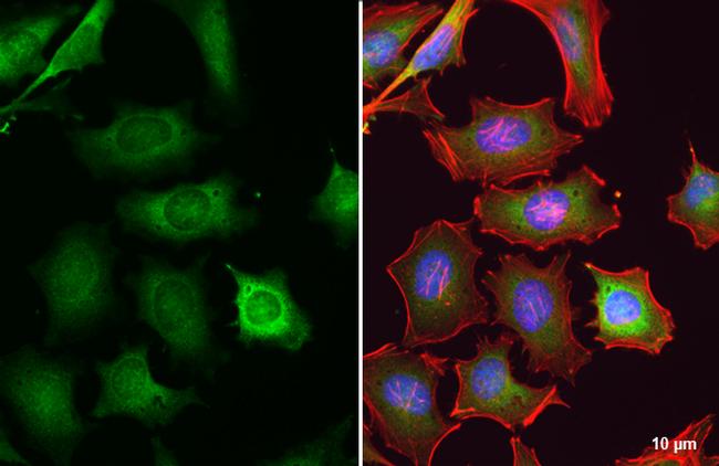 GSK3B Antibody in Immunocytochemistry (ICC/IF)