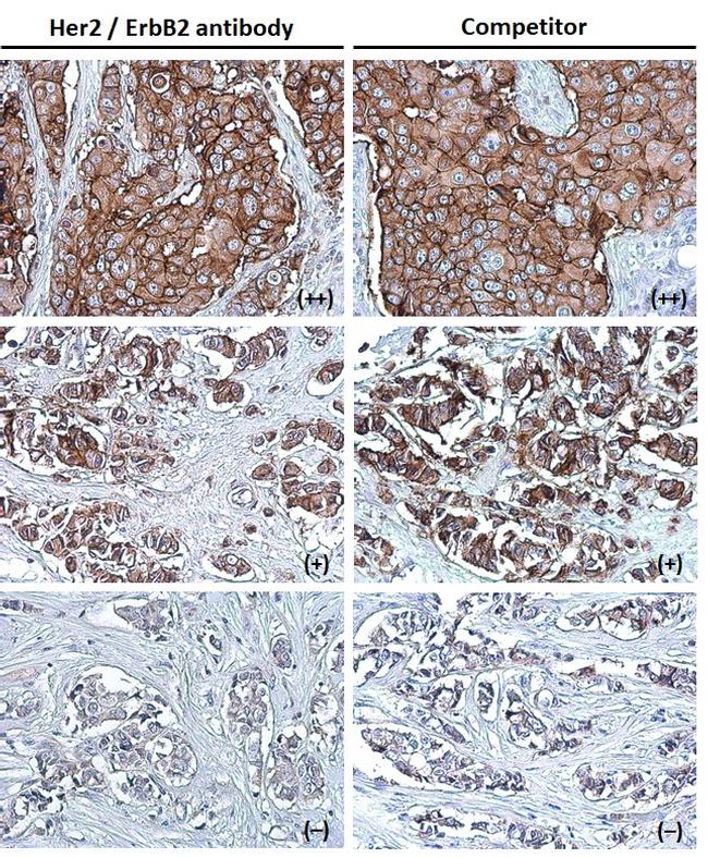 ErbB2 (HER-2) Antibody in Immunohistochemistry (Paraffin) (IHC (P))