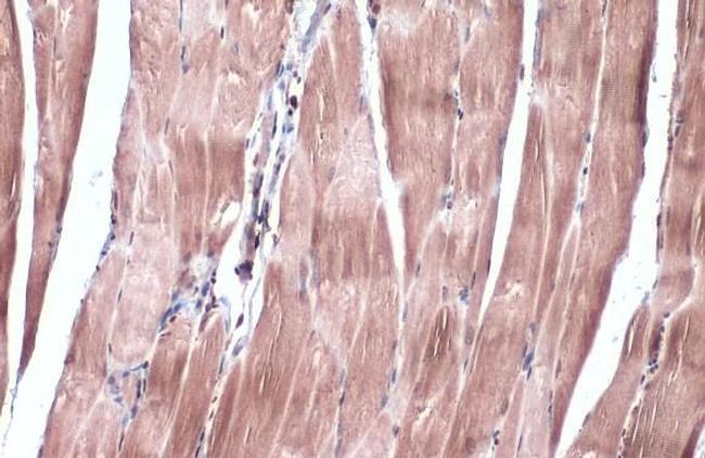 IRS2 Antibody in Immunohistochemistry (Paraffin) (IHC (P))