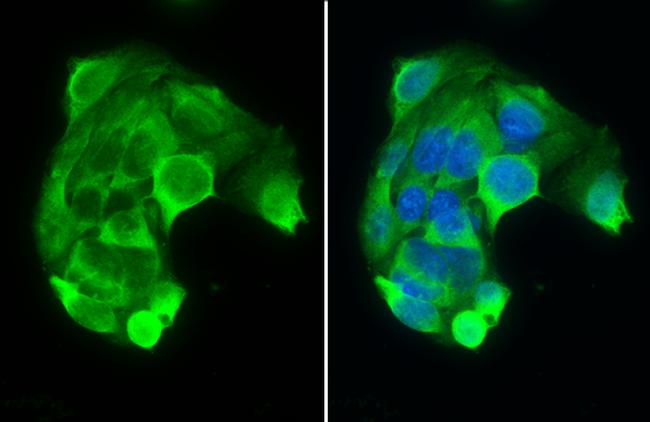 PAH Antibody in Immunocytochemistry (ICC/IF)