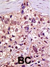 UBE1 Antibody in Immunohistochemistry (Paraffin) (IHC (P))