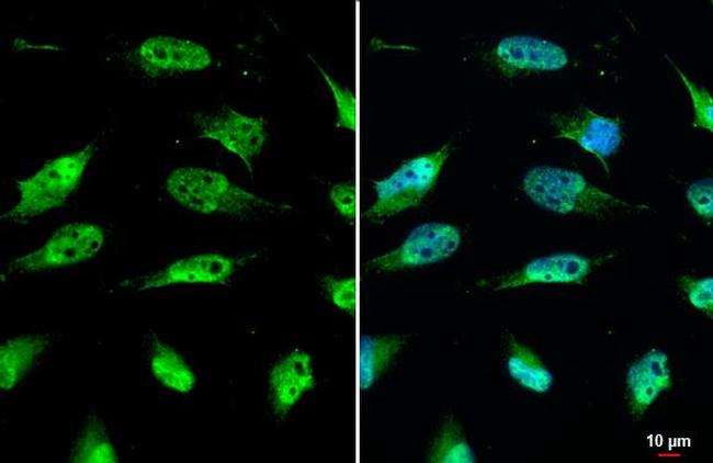 SIRT1 Antibody in Immunocytochemistry (ICC/IF)