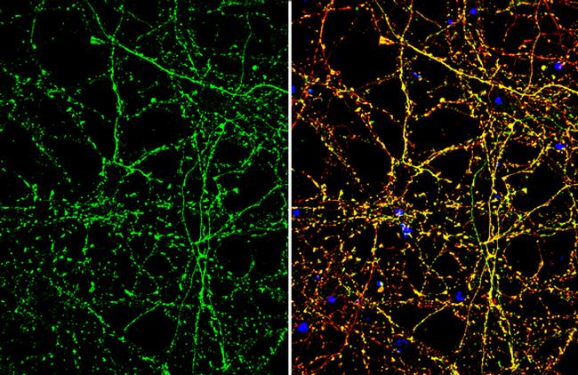 SLC1A7 Antibody in Immunocytochemistry (ICC/IF)