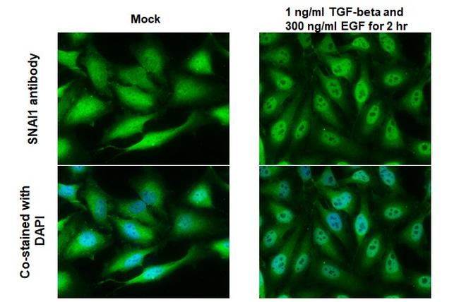 SNAIL Antibody in Immunocytochemistry (ICC/IF)