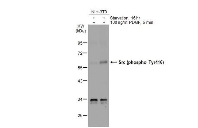 Phospho-SRC (Tyr416) Antibody in Western Blot (WB)