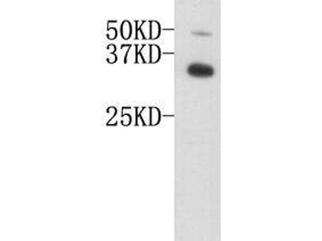 APOE Antibody in Western Blot (WB)