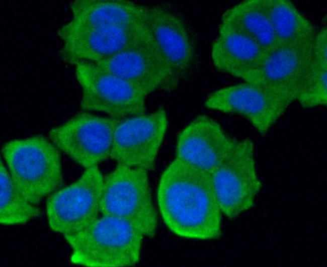 ROBO1 Antibody in Immunocytochemistry (ICC/IF)