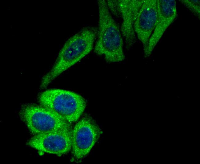 ROCK2 Antibody in Immunocytochemistry (ICC/IF)