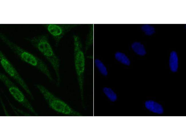 Fyn Antibody in Immunocytochemistry (ICC/IF)