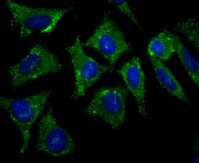 Protein APC Antibody in Immunocytochemistry (ICC/IF)