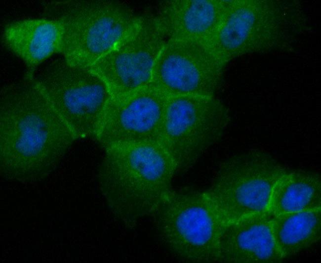 TROP2 Antibody in Immunocytochemistry (ICC/IF)