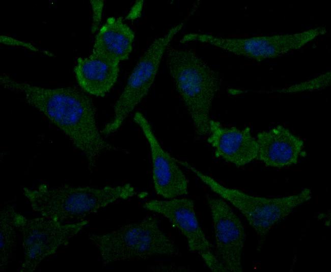 Aminoacylase Antibody in Immunocytochemistry (ICC/IF)