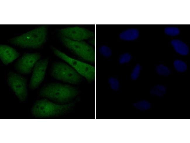 Galectin 3 Antibody in Immunocytochemistry (ICC/IF)