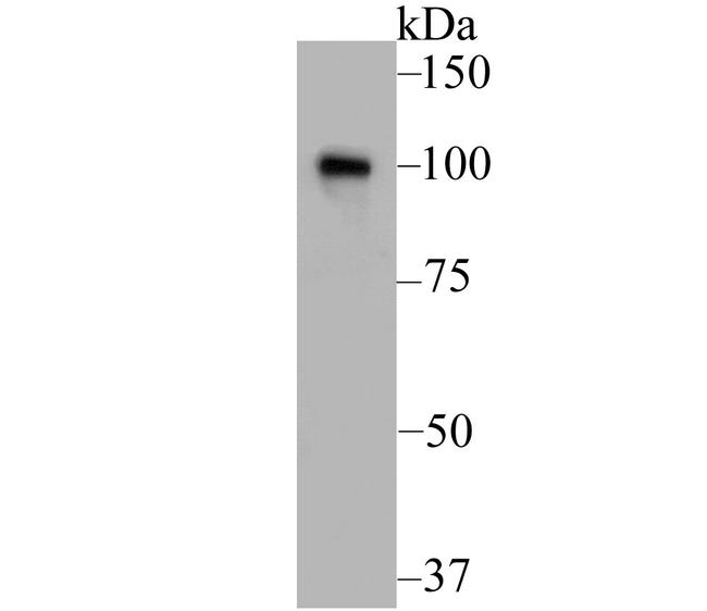 MSH2 Antibody in Western Blot (WB)