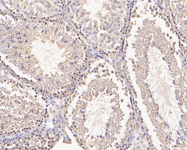 C2orf33 Antibody in Immunohistochemistry (Paraffin) (IHC (P))