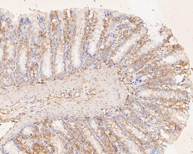 PYCR1 Antibody in Immunohistochemistry (Paraffin) (IHC (P))