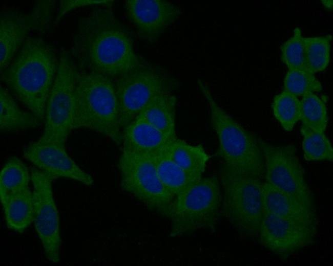 PICK1 Antibody in Immunocytochemistry (ICC/IF)