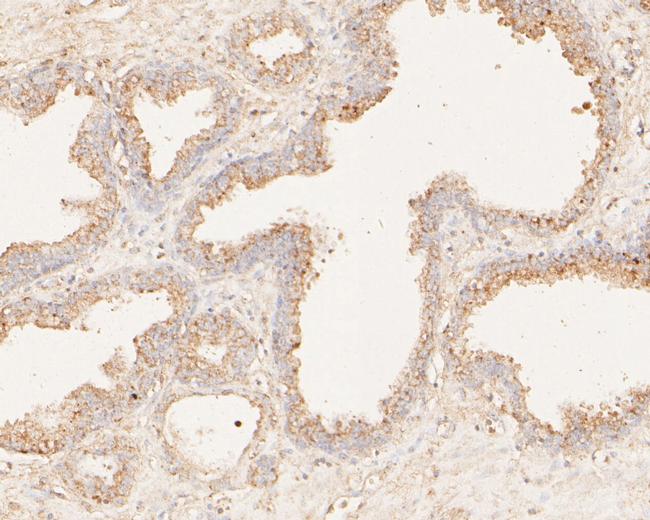 MAGT1 Antibody in Immunohistochemistry (Paraffin) (IHC (P))