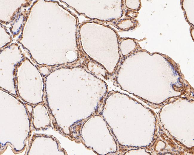 FYCO1 Antibody in Immunohistochemistry (Paraffin) (IHC (P))