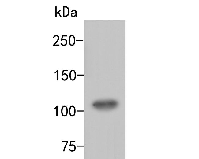 ARF16 Antibody in Western Blot (WB)