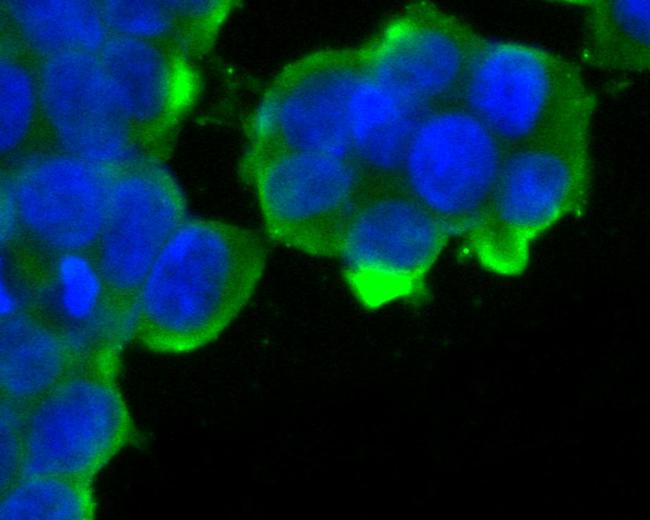 KCNQ4 Antibody in Immunocytochemistry (ICC/IF)