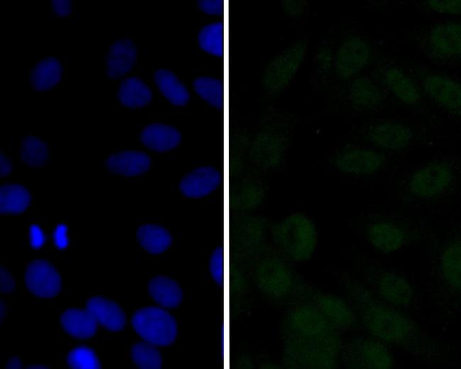 p16INK4a Antibody in Immunocytochemistry (ICC/IF)