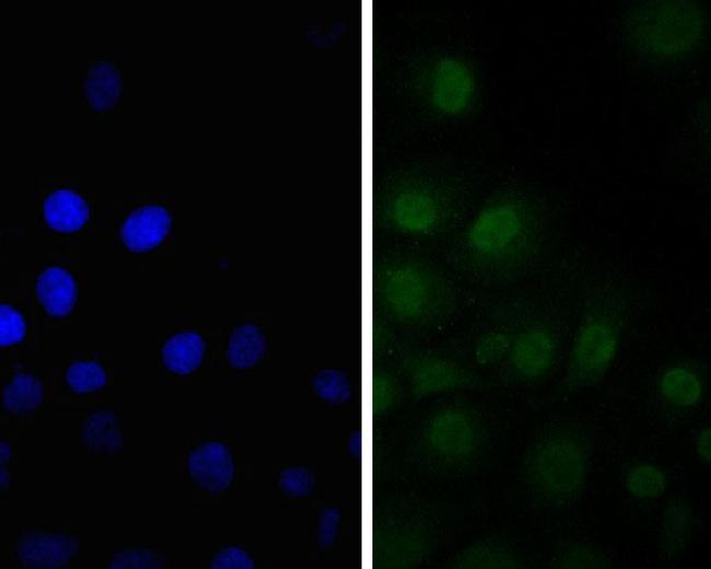 SSB Antibody in Immunocytochemistry (ICC/IF)