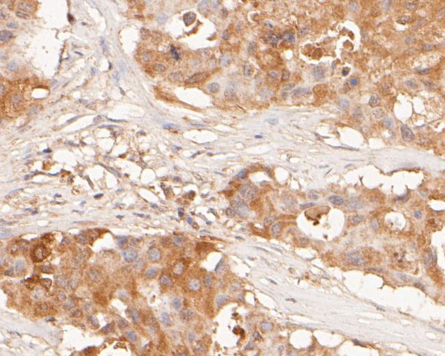 NAT13 Antibody in Immunohistochemistry (Paraffin) (IHC (P))