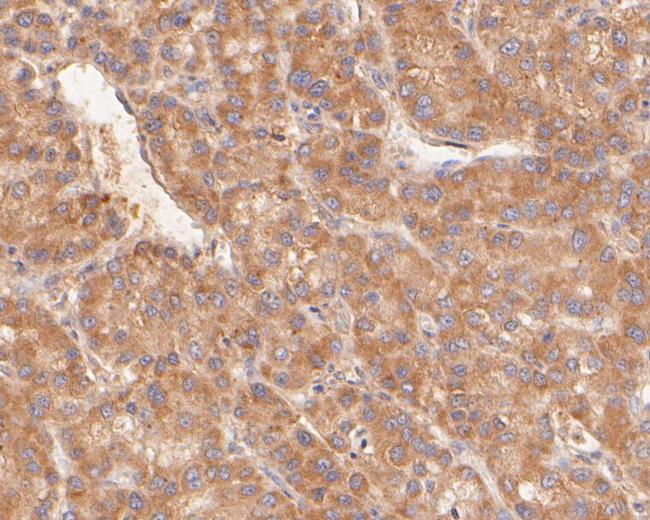 KAP3 Antibody in Immunohistochemistry (Paraffin) (IHC (P))