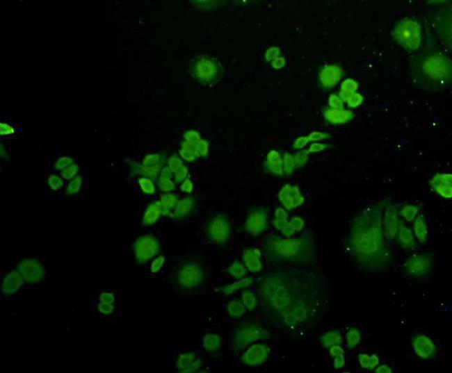 Ubiquitin Antibody in Immunocytochemistry (ICC/IF)