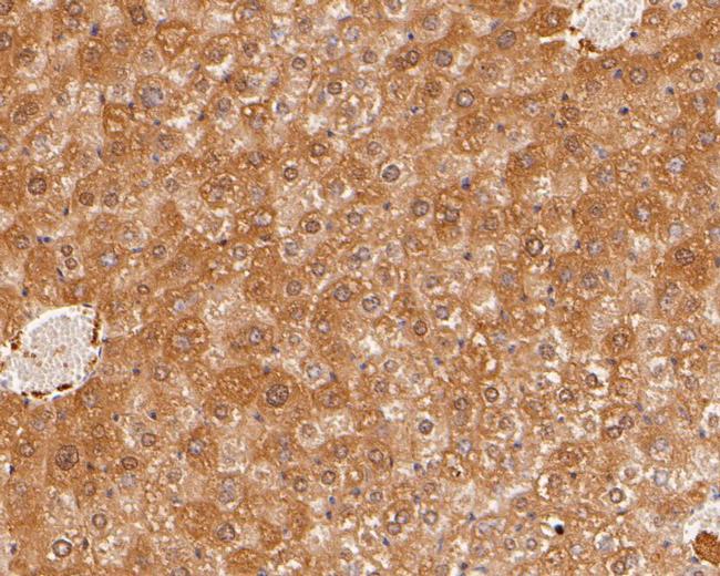 HPD Antibody in Immunohistochemistry (Paraffin) (IHC (P))