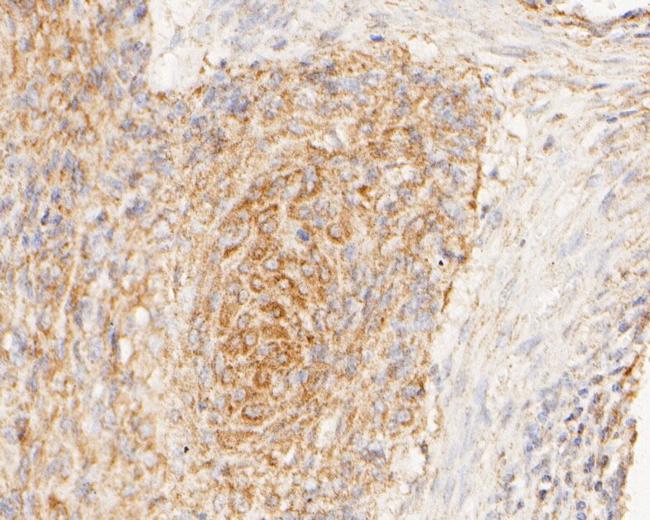 GRIK4 Antibody in Immunohistochemistry (Paraffin) (IHC (P))