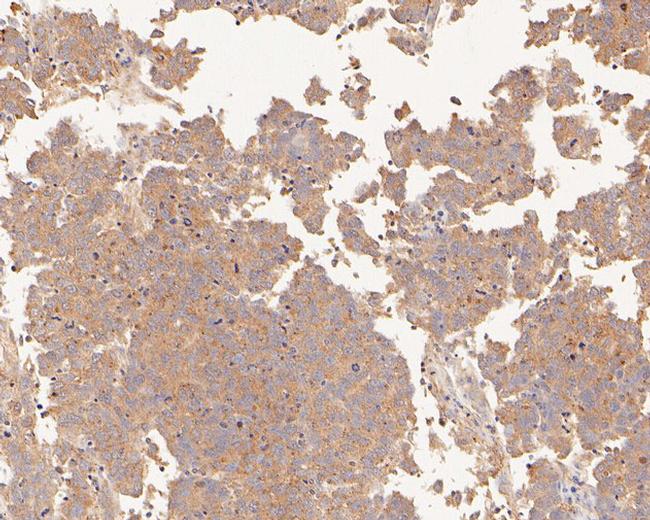 PDCD6 Antibody in Immunohistochemistry (Paraffin) (IHC (P))