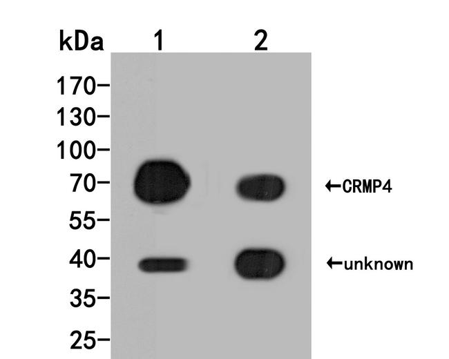 DPYSL3 Antibody in Western Blot (WB)