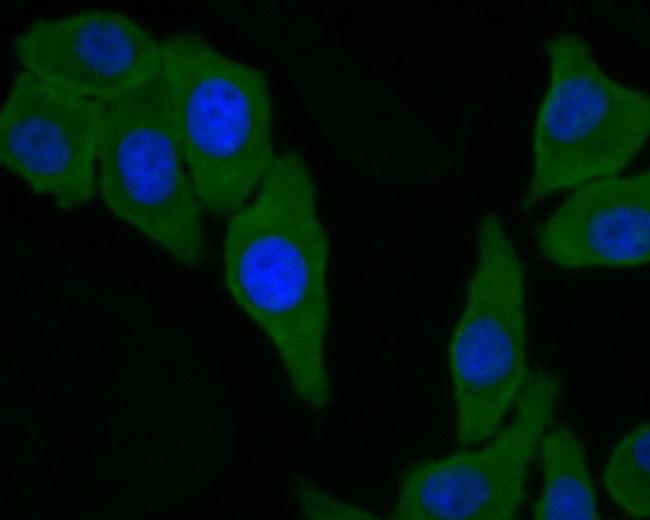 GFPT1 Antibody in Immunocytochemistry (ICC/IF)