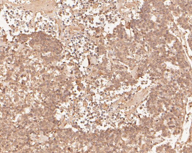 PHLDA1 Antibody in Immunohistochemistry (Paraffin) (IHC (P))