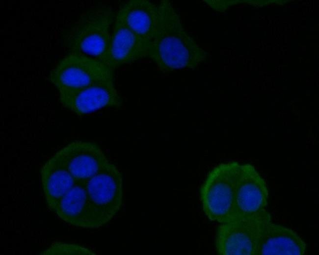 HSD3B1 Antibody in Immunocytochemistry (ICC/IF)