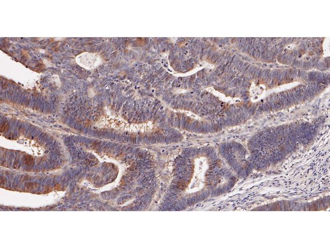 ADSL Antibody in Immunohistochemistry (Paraffin) (IHC (P))