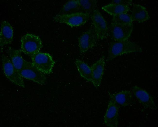 PER1 Antibody in Immunocytochemistry (ICC/IF)