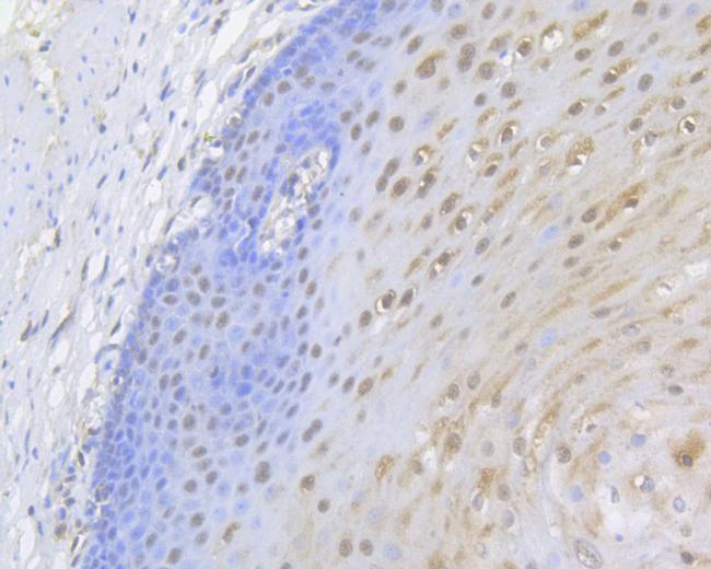 UAP56 Antibody in Immunohistochemistry (Paraffin) (IHC (P))