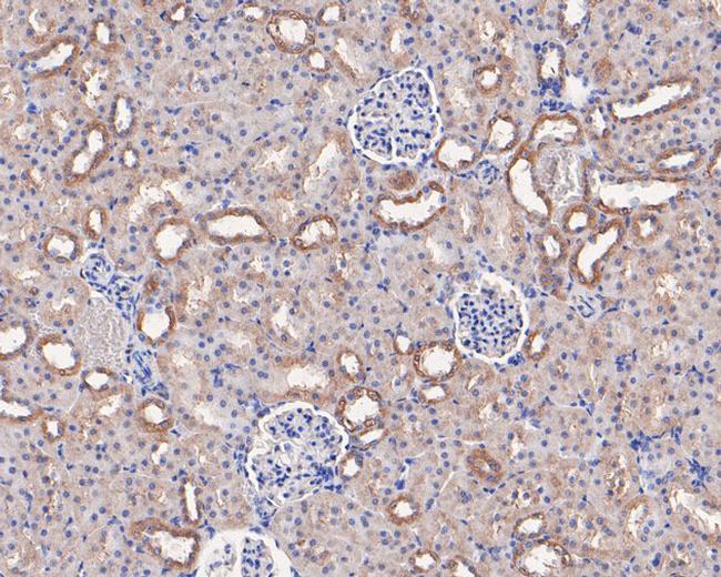 CD49c (Integrin alpha 3) Antibody in Immunohistochemistry (Paraffin) (IHC (P))