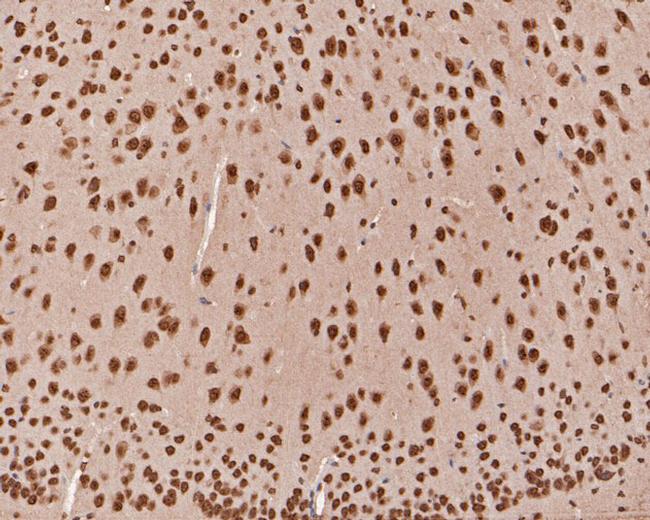 TCF21 Antibody in Immunohistochemistry (Paraffin) (IHC (P))