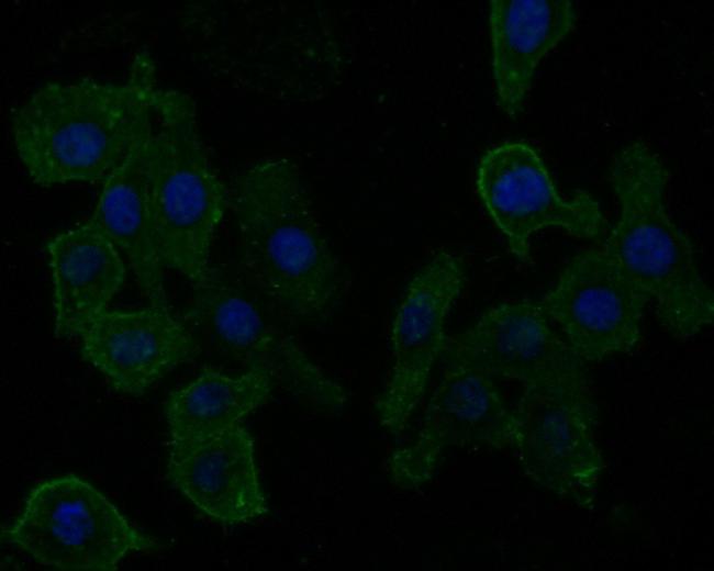 Aquaporin 4 Antibody in Immunocytochemistry (ICC/IF)