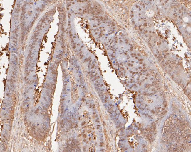 ONECUT3 Antibody in Immunohistochemistry (Paraffin) (IHC (P))